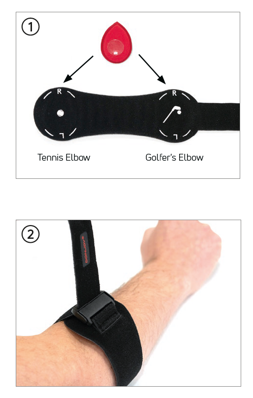 Epiforce Strong, Elbow Strap - Golfer And Tennis Elbow - Braces & Supports/Elbow Braces & Supports - DonJoy - Default Title - 190446716938